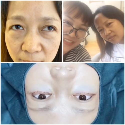 马蹄蝙蝠 马蹄蝙蝠长什么样