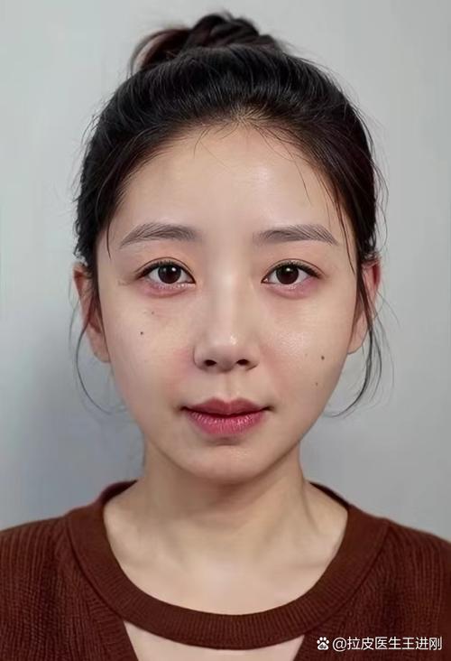 匆匆那年2之好久不见