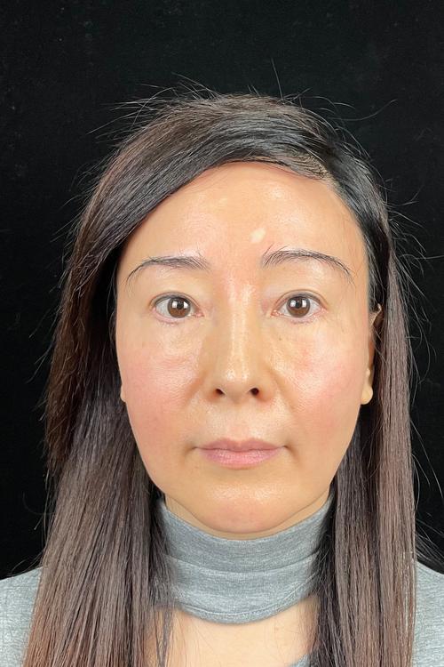 红玫瑰伴奏 红玫瑰伴奏张碧晨